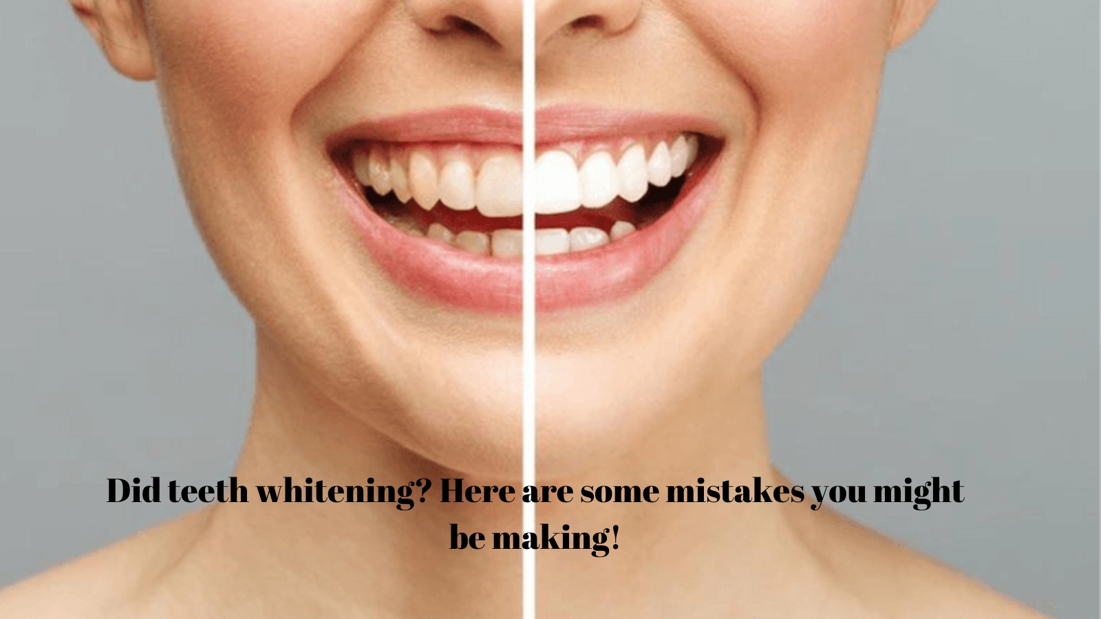 top 5 mistakes to avoid after teeth whitening