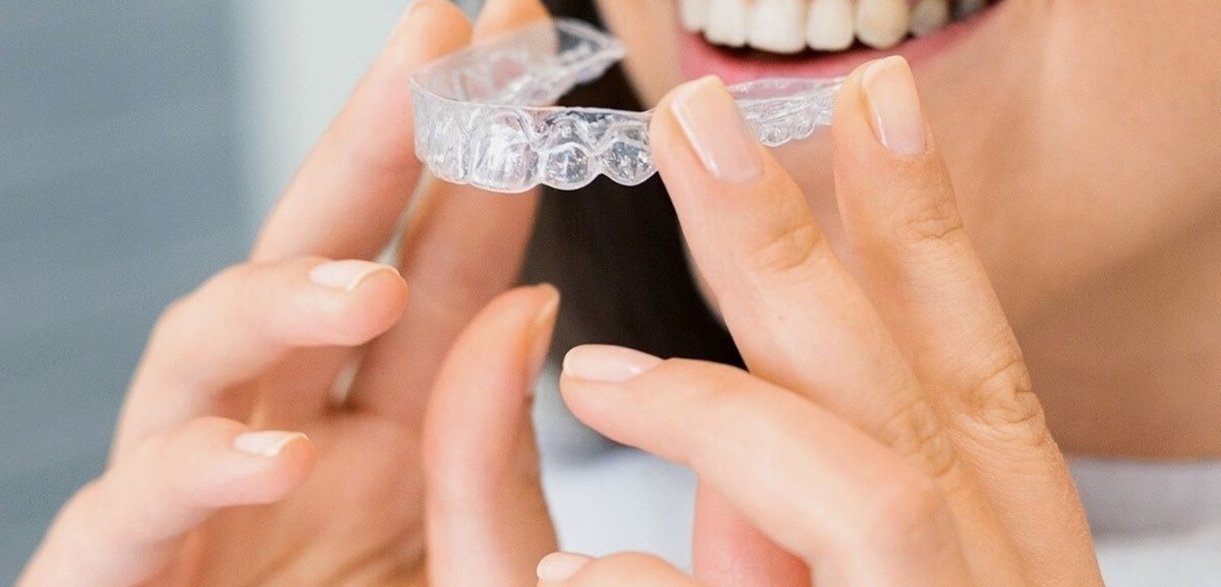 tips to clean and clear your invisalign aligners